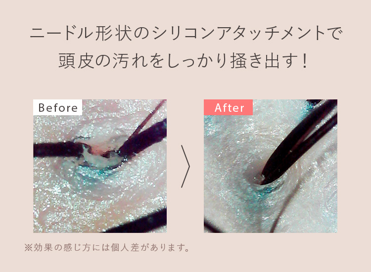 ニードル形状のシリコンアタッチメントで頭皮の汚れをしっかり掻き出す! ※効果の感じ方には個人差があります。