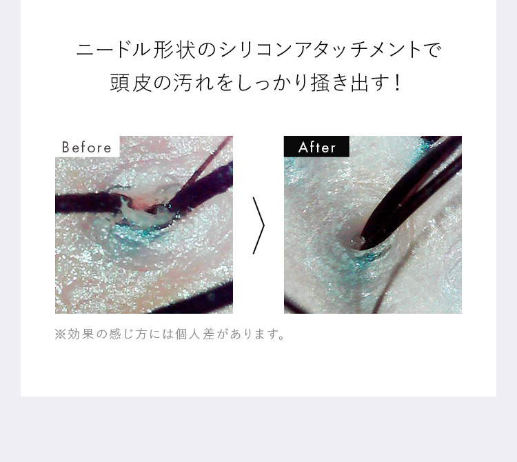 ニードル形状のシリコンアタッチメントで頭皮の汚れをしっかり掻き出す！